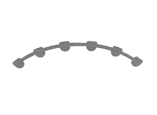 Lingual Retainer