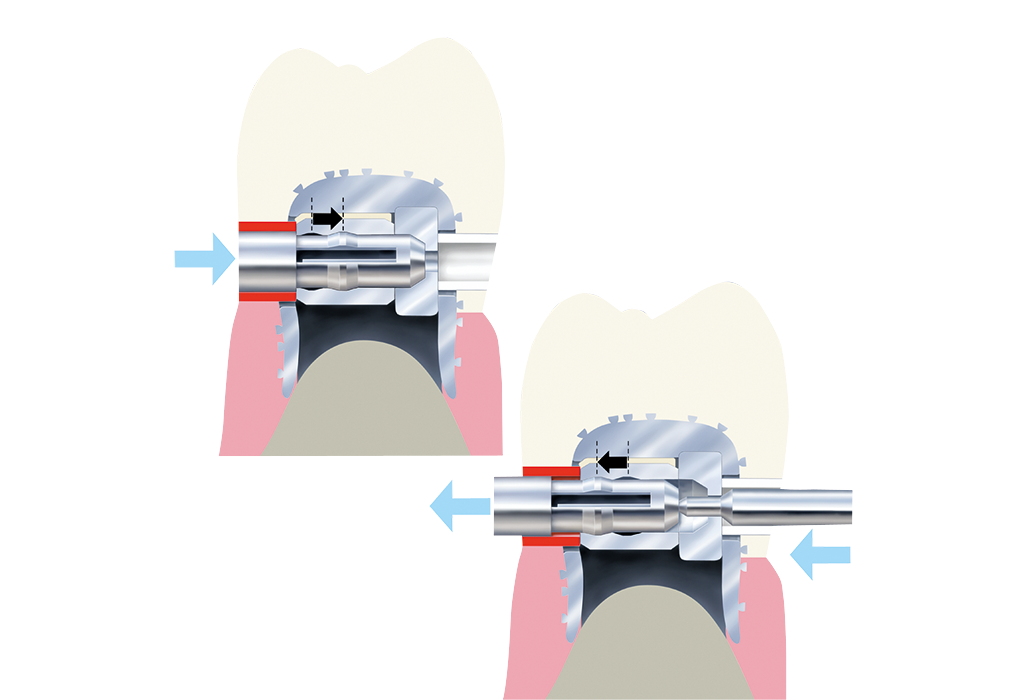 Snap-Slot latch