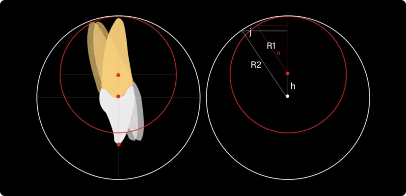 Smartee S5 Torque Movement in Orthodontics – Smartee, Intraoral Appliances