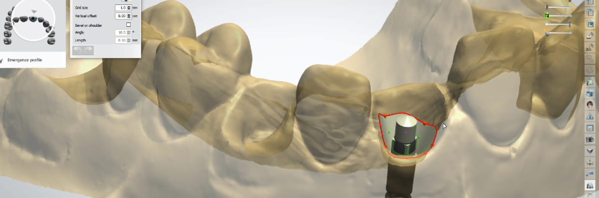 Système d'attachment Stern SNAP – Sterngold Dental, LLC, Instruments