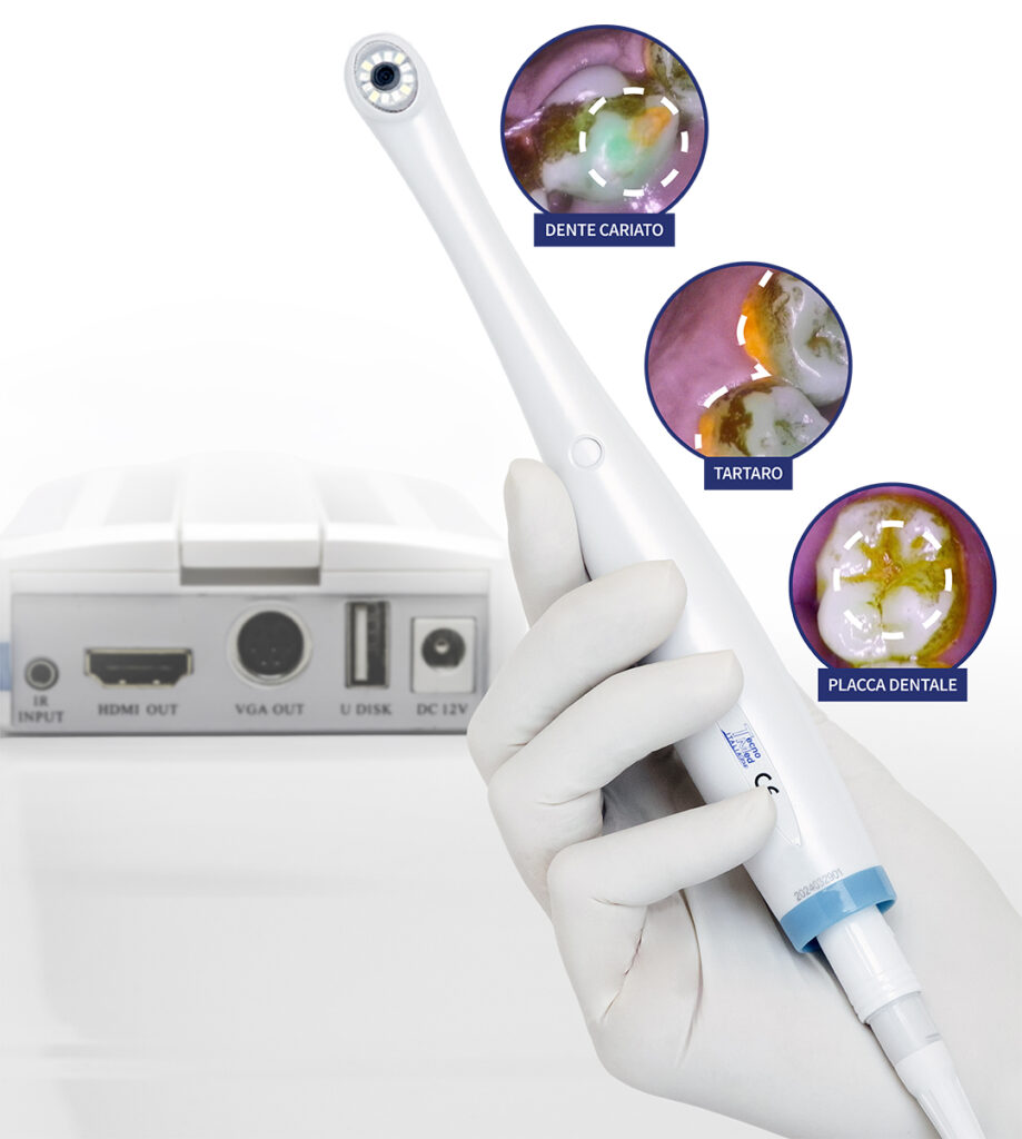 Telecamera Intraorale DETECT – Tecnomed Italia s.r.l., Intraoral Cameras