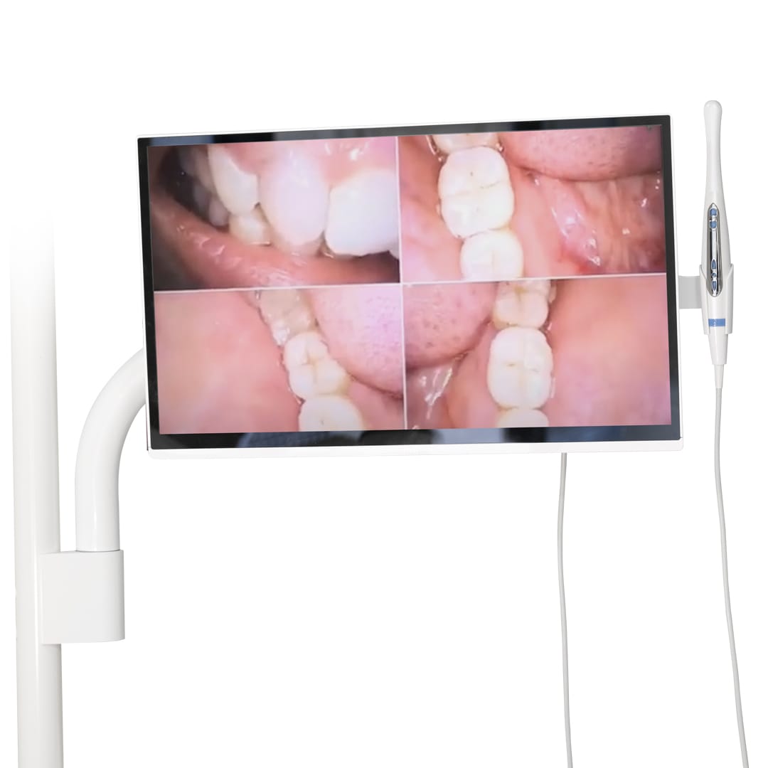 Kit Monitor Intraoral Camera Pole Mount – Tecnomed Italia s.r.l., Intraorale Kameras