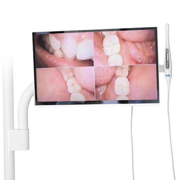 Kit Monitor Intraoral Camera Pole Mount