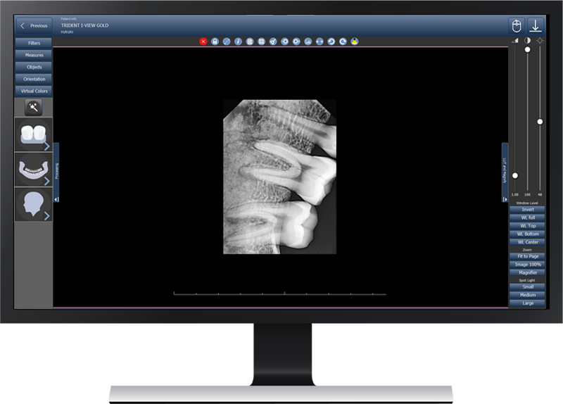 Software de imágenes dentales