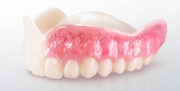 VIONIC TRY-IN RESIN