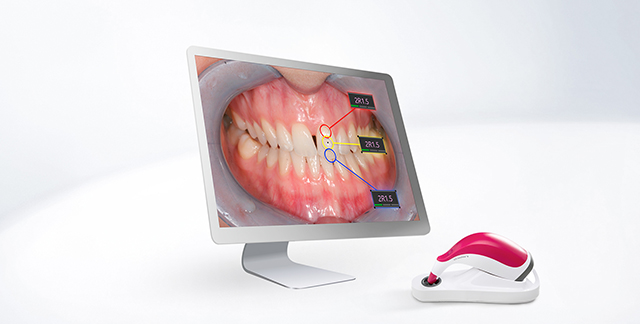 VITA Assist – VITA Zahnfabrik H. Rauter, CAD/CAM Software
