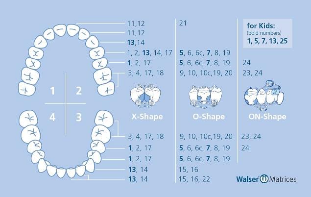 Matrices Sectionnelles Assortiments Walser – Dr. Walser Dental, Matrices