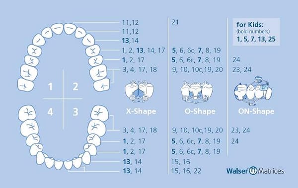 Matrices Sectionnelles Assortiments Walser