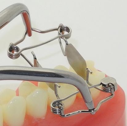 New tooth matrices for one-sided deep caries – Dr. Walser Dental, Matrizen
