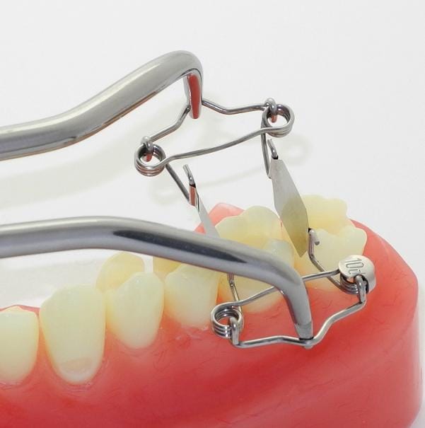 Neue Zahn-Matrize für extra tiefe Karies an einer Seite – Dr. Walser Dental, Matrizen