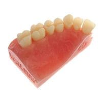 Walser model – Dr. Walser Dental, Matrices