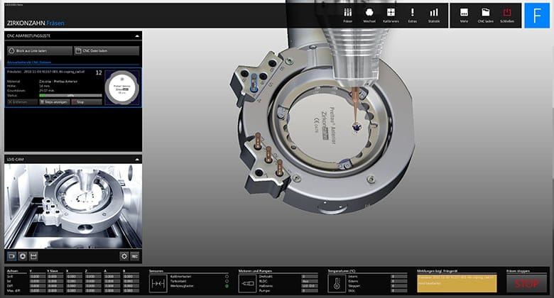 Zirkonzahn.Fräsen – Zirkonzahn, CAD/CAM Software
