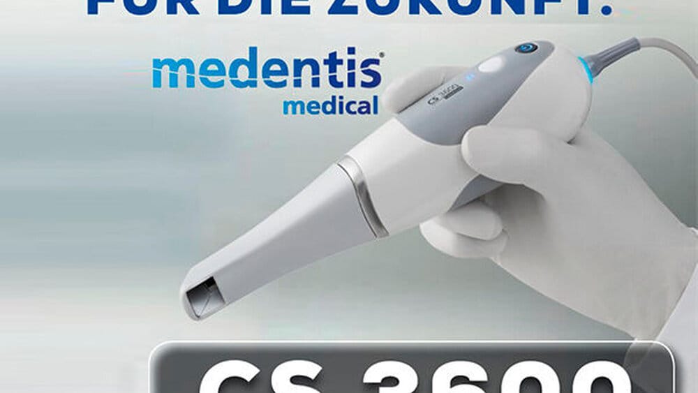 CS 3600: Scannen, so wie Sie es brauchen – zm - Zahnärztliche Mitteilungen, Intraoralscanner