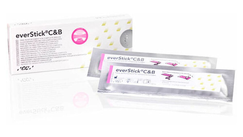 GC everStick – zm - Zahnärztliche Mitteilungen, Geschiebe