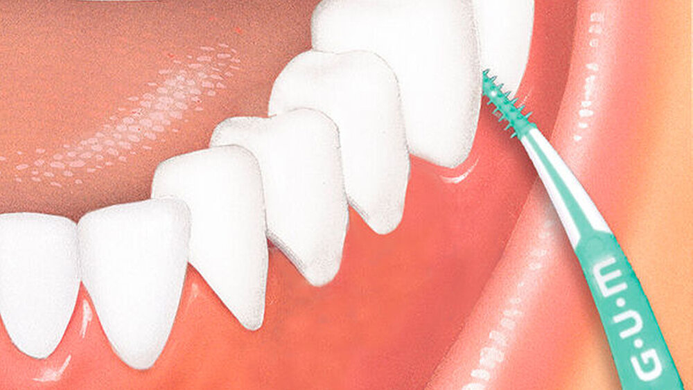GUM Soft-Picks Advanced – zm - Zahnärztliche Mitteilungen, Interdental Cleaners
