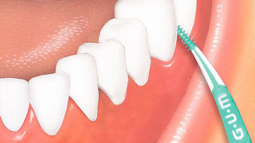GUM Soft-Picks Advanced – zm - Zahnärztliche Mitteilungen, Interdental Brushes