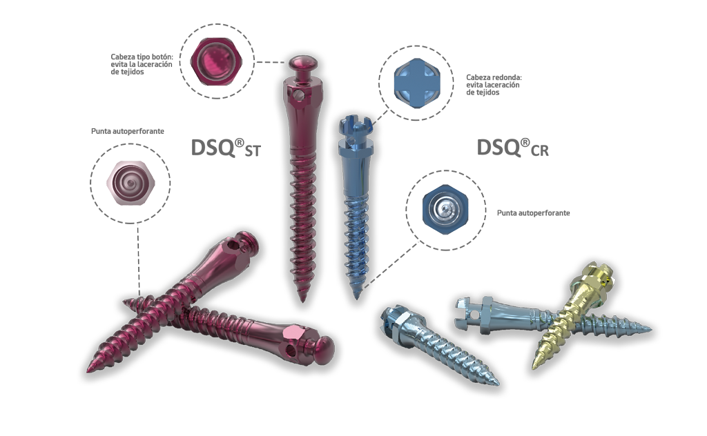Los microimplantes DSQ para tratamientos de ortodoncia – Ziacom Medical S.L.U, Anchorage Systems